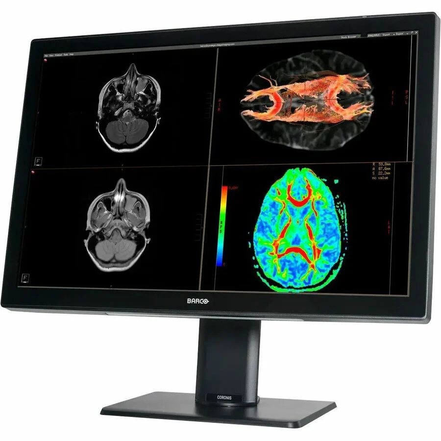 Barco Coronis Fusion MDCC-6530 30" Class LCD Monitor - 30.4" Viewable - In-plane Switching (IPS) Technology - LED Backlight - 3280 x 2048 - 1050 Nit - 18 ms - DisplayPort