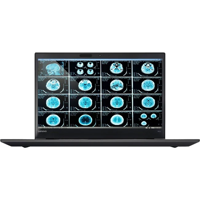 Lenovo ThinkPad 20JY0008CA 15.6" Mobile Workstation Ultrabook i7-6500U 16GB Win7 Pro